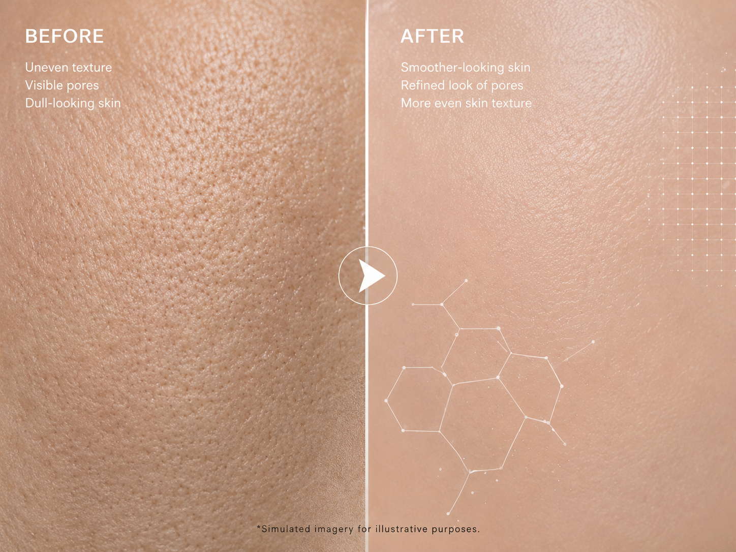 YinShun BHA Exfoliant 2% Salicylic Acid - Targeted Pore-Refining Serum for Oily & Congested-Looking Skin, Helps Minimize the look of Pores & Smooth Texture, 3.38 fl oz